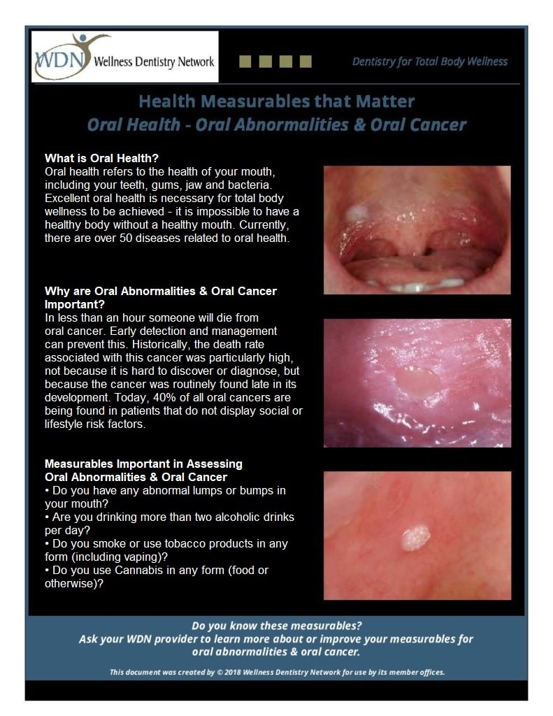 oral cancer