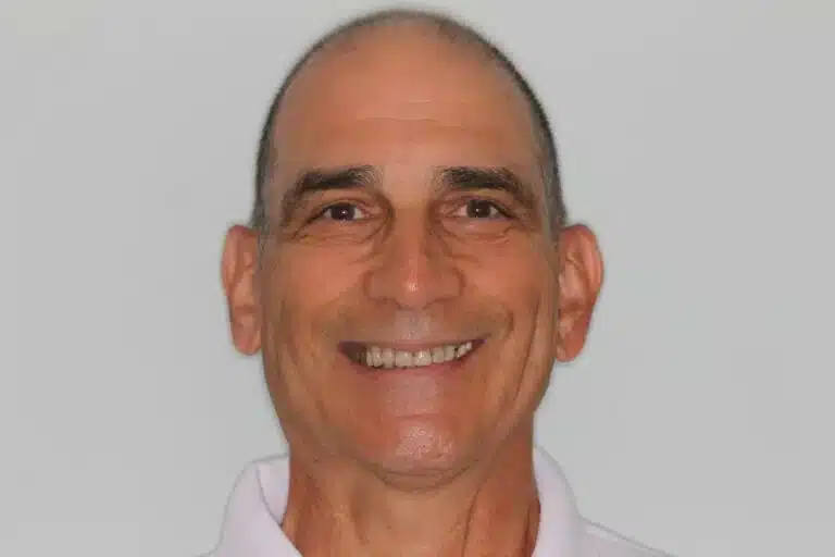 Before Image: Full Mouth Reconstruction - front